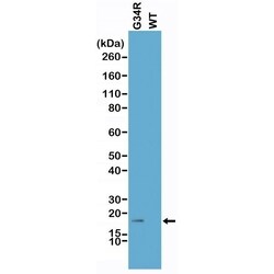 Invitrogen H3.3 G34R oncohistone mutant Recombinant Rabbit Monoclonal Antibody