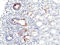 Invitrogen Helicobacter pylori Recombinant Rabbit Monoclonal Antibody (RM429)