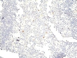 Invitrogen Phospho-Aurora A/B/C (Thr288, Thr232, Thr198) Recombinant Rabbit Monoclonal Antibody (RM454) 100 &mu;L | Buy Online | Invitrogen&trade; | Fisher Scientific