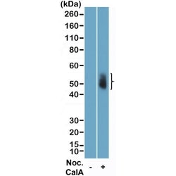 Invitrogen Phospho-Aurora A/B/C (Thr288, Thr232, Thr198) Recombinant Rabbit Monoclonal Antibody (RM454) 100 &mu;L | Buy Online | Invitrogen&trade; | Fisher Scientific