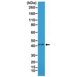 Invitrogen Alpha-Smooth Muscle Actin Recombinant Rabbit Monoclonal Antibody