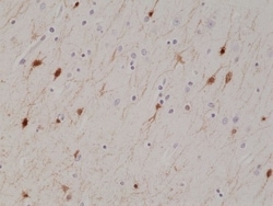 Invitrogen Calretinin Recombinant Rabbit Monoclonal Antibody (RM324) 100