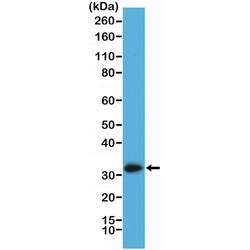 Invitrogen Calretinin Recombinant Rabbit Monoclonal Antibody (RM324) 100