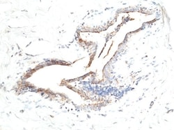 Invitrogen Asprosin Recombinant Rabbit Monoclonal Antibody (RM463) 100