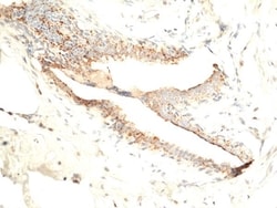 Invitrogen Asprosin Recombinant Rabbit Monoclonal Antibody (RM463) 100