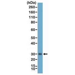 Invitrogen Asprosin Recombinant Rabbit Monoclonal Antibody (RM463) 100