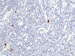 Invitrogen Granzyme B Recombinant Rabbit Monoclonal Antibody (RM441) 100 &mu;L | Buy Online | Invitrogen&trade; | Fisher Scientific