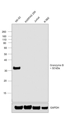 Invitrogen Granzyme B Recombinant Rabbit Monoclonal Antibody (RM441) 100 &mu;L | Buy Online | Invitrogen&trade; | Fisher Scientific