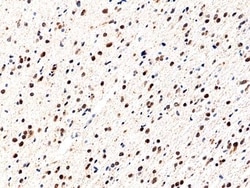 Invitrogen IDH1 (R132H) Recombinant Rabbit Monoclonal Antibody (RM390)