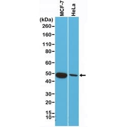 Invitrogen Cytokeratin 18 Recombinant Rabbit Monoclonal Antibody (RM279)