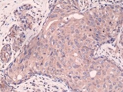 Invitrogen SMAD4 Recombinant Rabbit Monoclonal Antibody (RM277) 100 &mu;L;