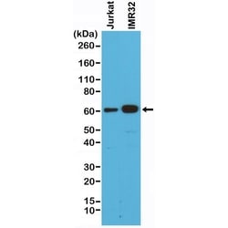 Invitrogen SMAD4 Recombinant Rabbit Monoclonal Antibody (RM277) 100 &mu;L;