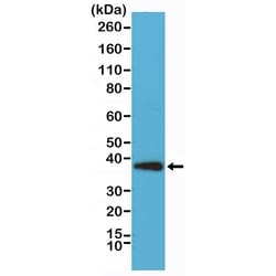 Invitrogen Synaptophysin Recombinant Rabbit Monoclonal Antibody (RM258)