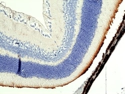 Invitrogen MERTK Recombinant Rabbit Monoclonal Antibody (RM469) 100 &mu;L;