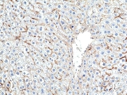 Invitrogen MERTK Recombinant Rabbit Monoclonal Antibody (RM469) 100 &mu;L;