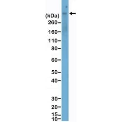 Invitrogen MERTK Recombinant Rabbit Monoclonal Antibody (RM469) 100 &mu;L;