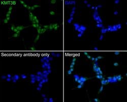 Invitrogen NSD1 Recombinant Rabbit Monoclonal Antibody (1B1) 100 &mu;L;