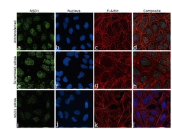Invitrogen NSD1 Recombinant Rabbit Monoclonal Antibody (1B1) 100 &mu;L;