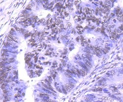 Invitrogen PTBP1 Monoclonal Antibody (5C1) 100 &mu;L; Unconjugated:Antibodies,