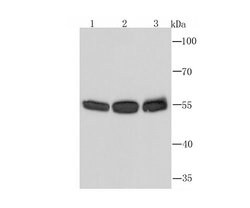 Invitrogen PTBP1 Monoclonal Antibody (5C1) 100 &mu;L; Unconjugated:Antibodies,