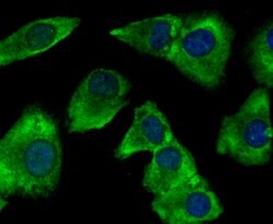 Invitrogen gamma Tubulin Monoclonal Antibody (10-A4) 100 &mu;L; Unconjugated:Antibodies,