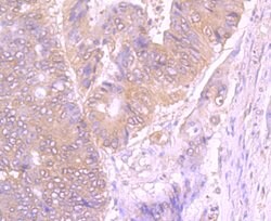 Invitrogen gamma Tubulin Monoclonal Antibody (10-A4) 100 &mu;L; Unconjugated:Antibodies,