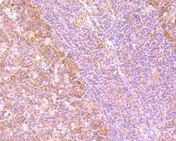 Invitrogen gamma Tubulin Monoclonal Antibody (10-A4) 100 &mu;L; Unconjugated:Antibodies,