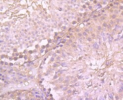 Invitrogen gamma Tubulin Monoclonal Antibody (10-A4) 100 &mu;L; Unconjugated:Antibodies,