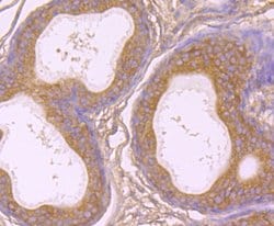 Invitrogen gamma Tubulin Monoclonal Antibody (10-A4) 100 &mu;L; Unconjugated:Antibodies,
