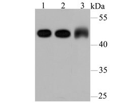 Invitrogen gamma Tubulin Monoclonal Antibody (10-A4) 100 &mu;L; Unconjugated:Antibodies,