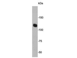 Invitrogen JAK2 Monoclonal Antibody (6-D3) 100 &mu;L; Unconjugated:Antibodies,