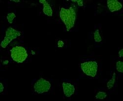 Invitrogen Desmin Monoclonal Antibody (3-F7) 100 &mu;L | Buy Online | Invitrogen&trade; | Fisher Scientific