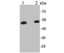 Invitrogen Desmin Monoclonal Antibody (3-F7) 100 &mu;L | Buy Online | Invitrogen&trade; | Fisher Scientific