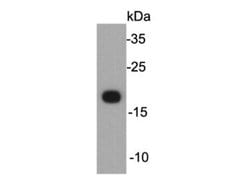 Invitrogen Claudin 7 Monoclonal Antibody (6-G3) 100 &mu;L; Unconjugated:Antibodies,