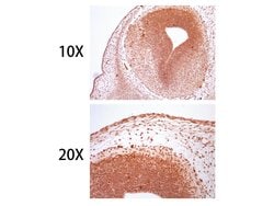 Invitrogen SOX10 Monoclonal Antibody (1-11) 100 &mu;L; Unconjugated:Antibodies,