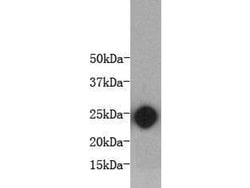 Invitrogen IL-6 Monoclonal Antibody (3-A4) 100 &mu;L; Unconjugated:Antibodies,