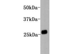 Invitrogen Kappa Light Chain Monoclonal Antibody (A11-G11) 100 &mu;L; Unconjugated:Antibodies,