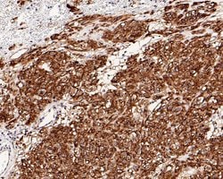 Invitrogen DOG-1 Recombinant Rabbit Monoclonal Antibody (PO00-27) 100 &mu;L;