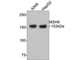 Invitrogen MSH6 Recombinant Rabbit Monoclonal Antibody (PD00-26) 100 &mu;L;