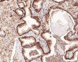 Invitrogen CD47 Recombinant Rabbit Monoclonal Antibody (PD00-33) 100 &mu;L;