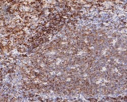 Invitrogen CD22 Recombinant Rabbit Monoclonal Antibody (PO00-31) 100 &mu;L;