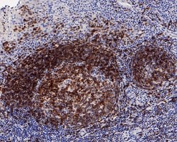 Invitrogen CD22 Recombinant Rabbit Monoclonal Antibody (PO00-31) 100 &mu;L;