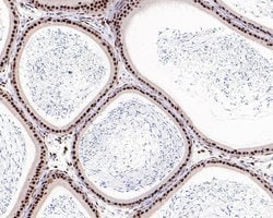 Invitrogen Androgen Receptor Recombinant Rabbit Monoclonal Antibody (PO00-29) 100 &mu;L | Buy Online | Invitrogen&trade; | Fisher Scientific