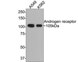 Invitrogen Androgen Receptor Recombinant Rabbit Monoclonal Antibody (PO00-29) 100 &mu;L | Buy Online | Invitrogen&trade; | Fisher Scientific