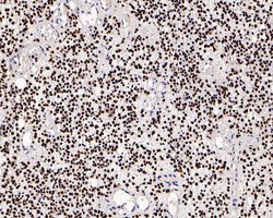 Invitrogen SOX2 Recombinant Rabbit Monoclonal Antibody (PO00-28) 100 &mu;L;