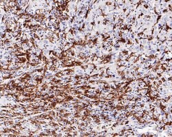 Invitrogen CD16 Recombinant Rabbit Monoclonal Antibody (PD00-12) 100 &mu;L;