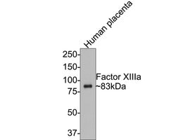Invitrogen Factor XIII A Recombinant Rabbit Monoclonal Antibody (PD00-08)