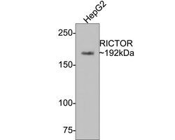 Invitrogen RICTOR Recombinant Rabbit Monoclonal Antibody (1A5) 100 &mu;L;