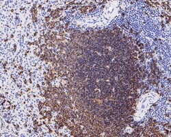 Invitrogen CD20 Recombinant Rabbit Monoclonal Antibody (PD00-02) 100 &mu;L;