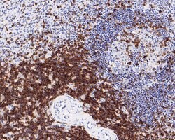 Invitrogen CD5 Recombinant Rabbit Monoclonal Antibody (PD00-01) 100 &mu;L | Buy Online | Invitrogen&trade; | Fisher Scientific